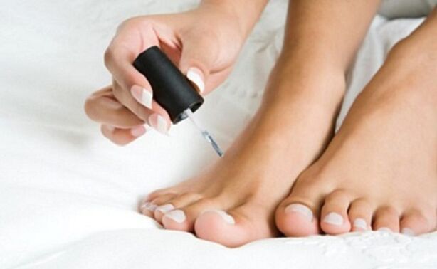 Healing varnish in nail fungus
